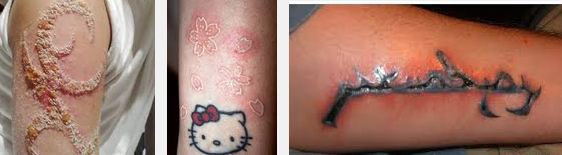 Tattoo infection at different locations