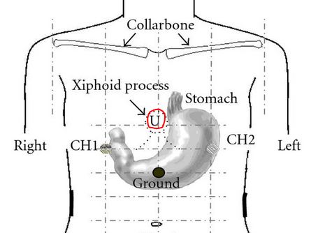 Xiphoid process