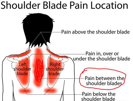 pain between shoulder blades