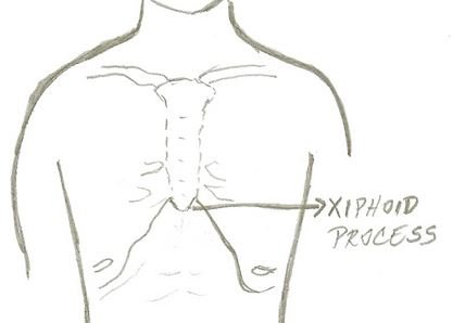 Xiphoid Process - Location, Pain, Definition, Treatment