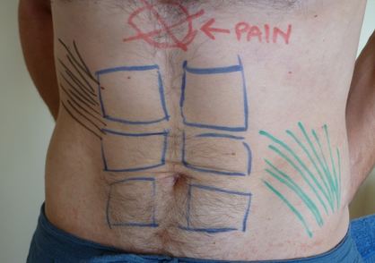 xiphoid process pain location