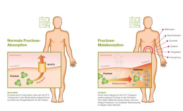 Fructose malabsorption