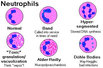 Normal and abnormal neutrophils