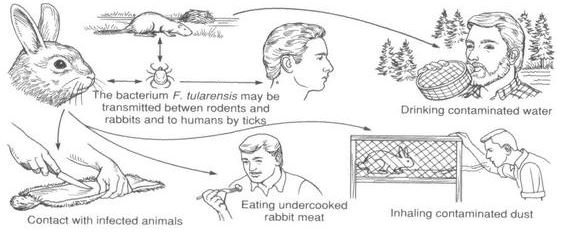 cause of Tularemia