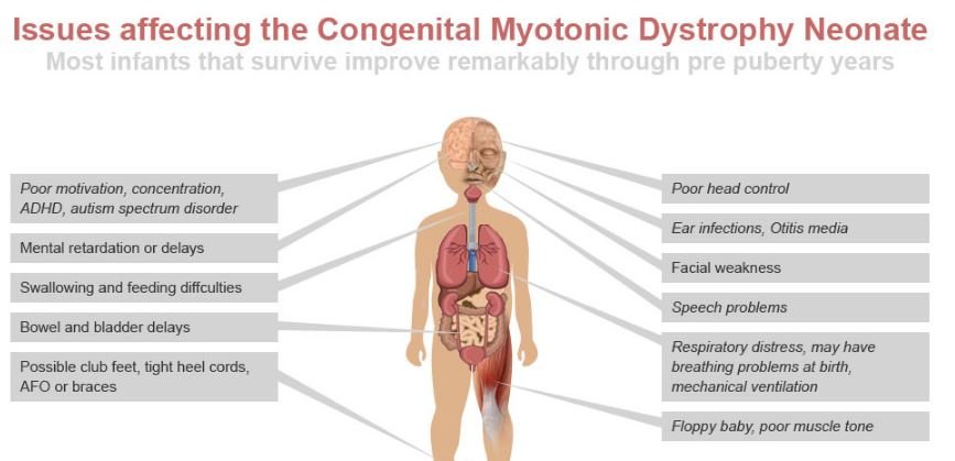 What are the most prevalent symptoms of muscular dystrophy in children?