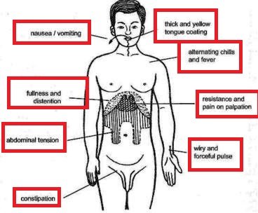 Symptoms-of-Sulfur-Burps