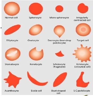 Classification of Poikilocytes