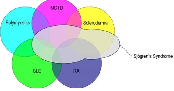 Mixed Connective Tissue Disease differential diagnosis