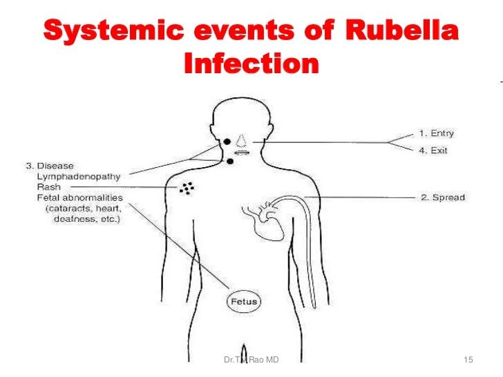 rubella-infection-entry-n-exit