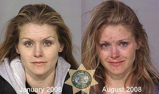 Methamphetamine before and after