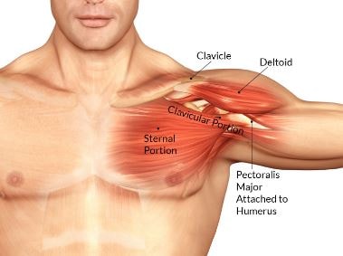 Pectoralis Muscle Torn 3