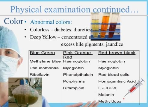 Physical examination of urine examination