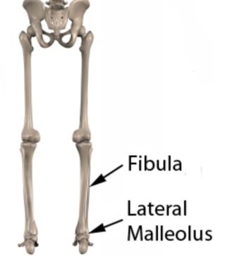 Lateral Malleolus image