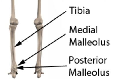posterior medial Malleolus 