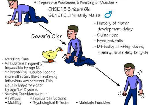 Symptoms Of Duchenne Muscular Dystrophy