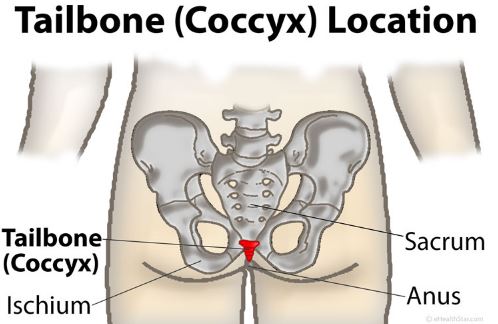 coccyx pain tailbone location