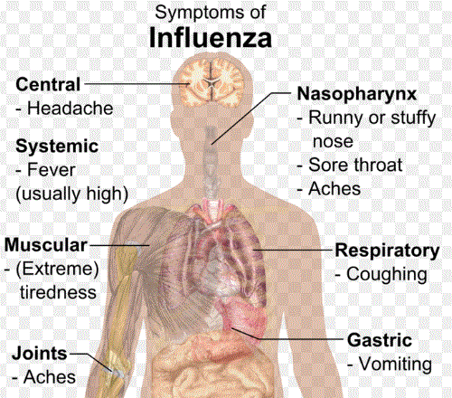 Influenca Symptoms